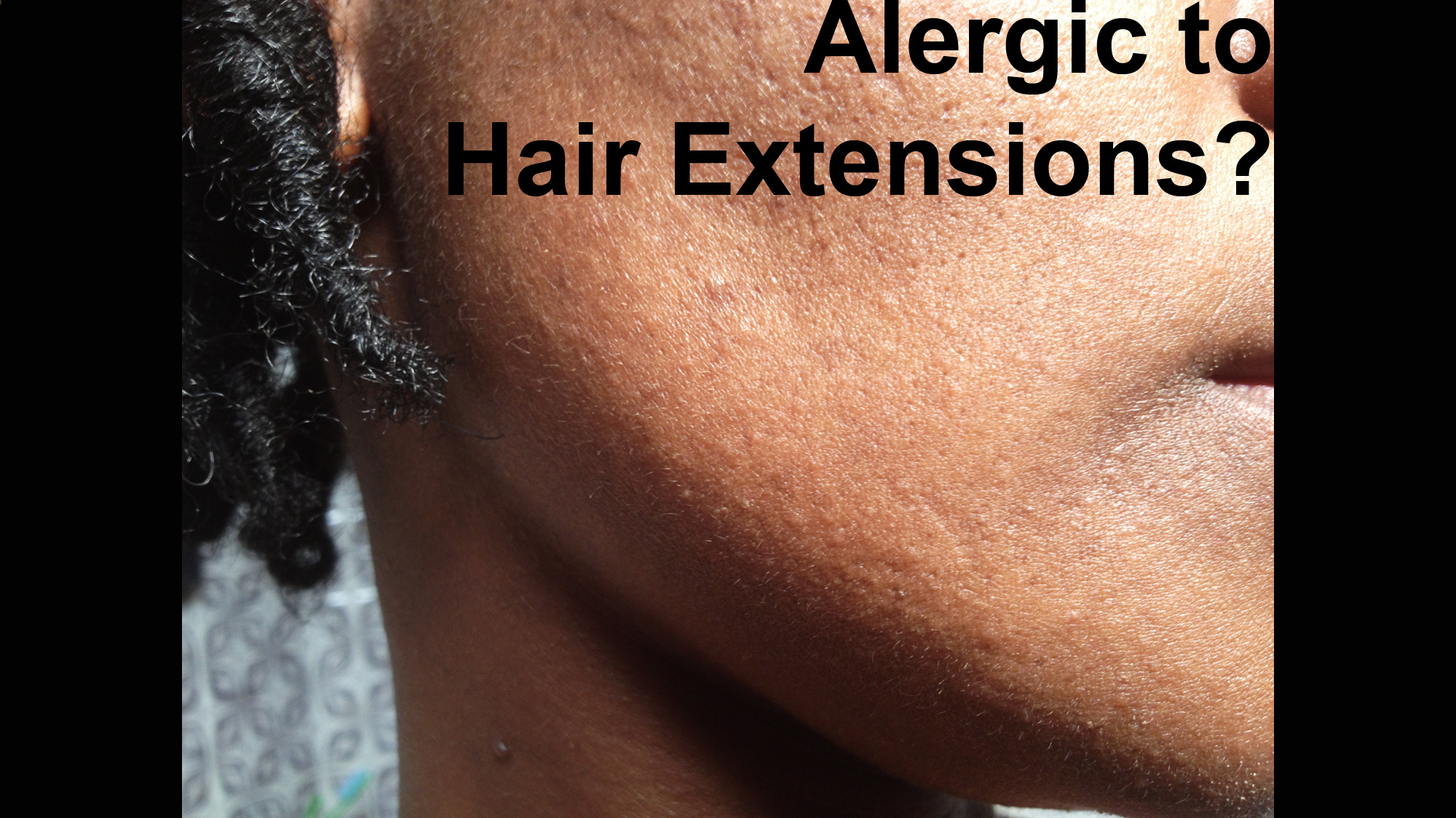 Allergic to Hair Extensions?